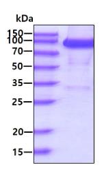 SDS-PAGE (CD6-05H).jpg
